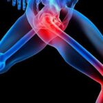 Навчальний семінар "Лікування великих суглобів"